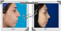 عمل بینی شماره 650