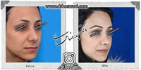 عمل بینی شماره 651