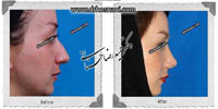 عمل بینی شماره 654