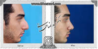 عمل بینی شماره 655