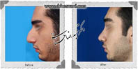 عمل بینی شماره 656