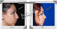 عمل بینی شماره 660