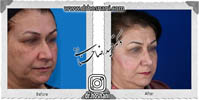 عمل بینی شماره 661