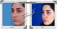 عمل بینی شماره 664