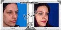 عمل بینی شماره 668
