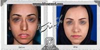 عمل بینی شماره 669