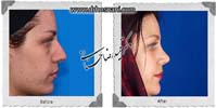 عمل بینی شماره 670