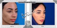 عمل بینی شماره 671