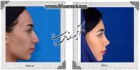 عمل بینی شماره 672