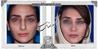 عمل بینی شماره 675