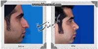 عمل بینی شماره 677