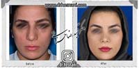 عمل بینی شماره 678