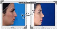 عمل بینی شماره 679