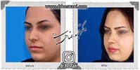 عمل بینی شماره 680