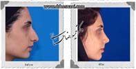  جراحی بینی -683