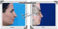 عمل بینی شماره 689