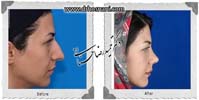 عمل بینی شماره 691
