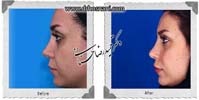 عمل بینی شماره 697