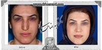 عمل بینی شماره 702