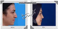 عمل بینی شماره 703