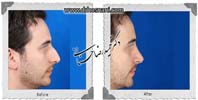 عمل بینی شماره 705