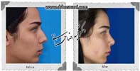 عمل بینی شماره 707