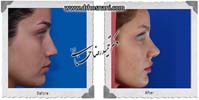 عمل بینی شماره 721