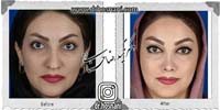 عمل بینی شماره 729