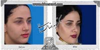 عمل بینی شماره 731