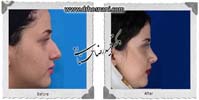 عمل بینی شماره 734