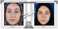 عمل بینی شماره 735