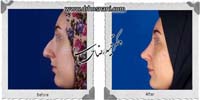 عمل بینی شماره 738
