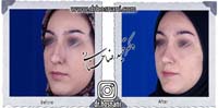 عمل بینی شماره 739