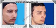 عمل بینی شماره 743