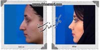 عمل بینی شماره 747