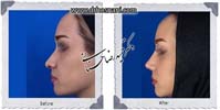 عمل بینی شماره 749