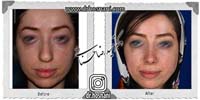 عمل بینی شماره 750