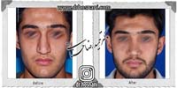 عمل بینی شماره 756