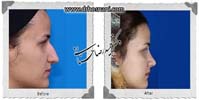 عمل بینی شماره 759
