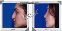 عمل بینی شماره 763