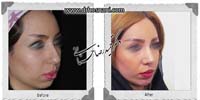 عمل بینی شماره 767