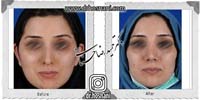 عمل بینی شماره 768