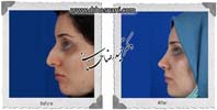 عمل بینی شماره 769