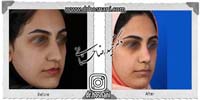 عمل بینی شماره 770