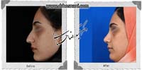 عمل بینی شماره 771