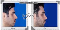  جراحی بینی -783