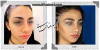 عمل بینی شماره 785
