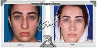 عمل بینی شماره 790