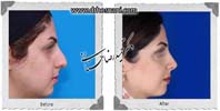عمل بینی شماره 827