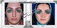 عمل بینی شماره 830